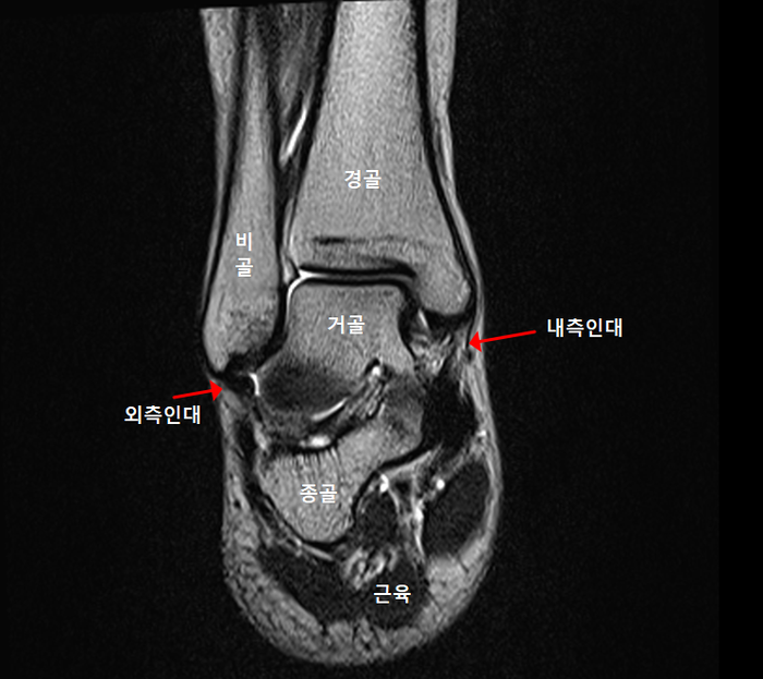 발목뼈와 인대
