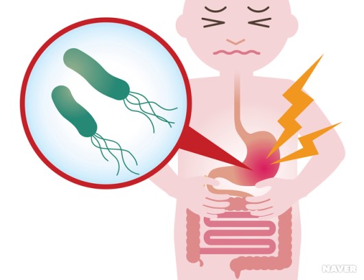 <출처: 네이버 지식백과,  서울대학교병원 의학정보>