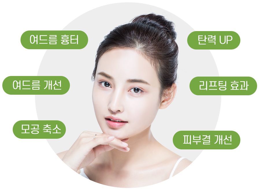 스크릿레이저_추천대상
