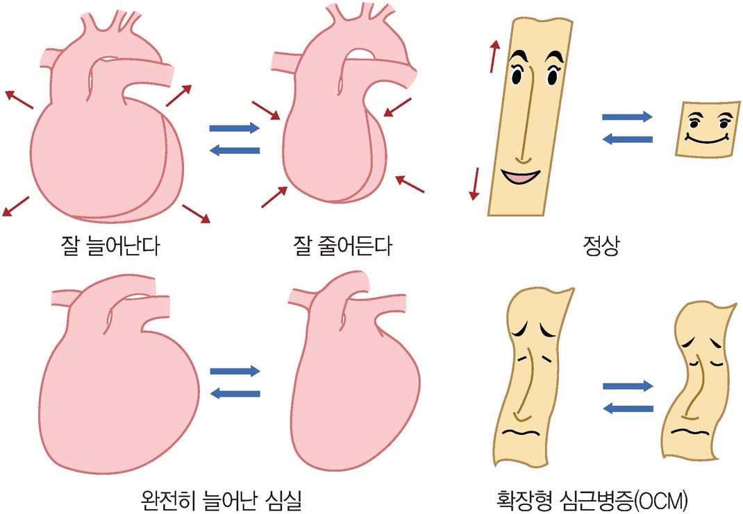 <출처: 해부 병태생리로 이해하는 SIM 통합내과학 3 : 순환기>