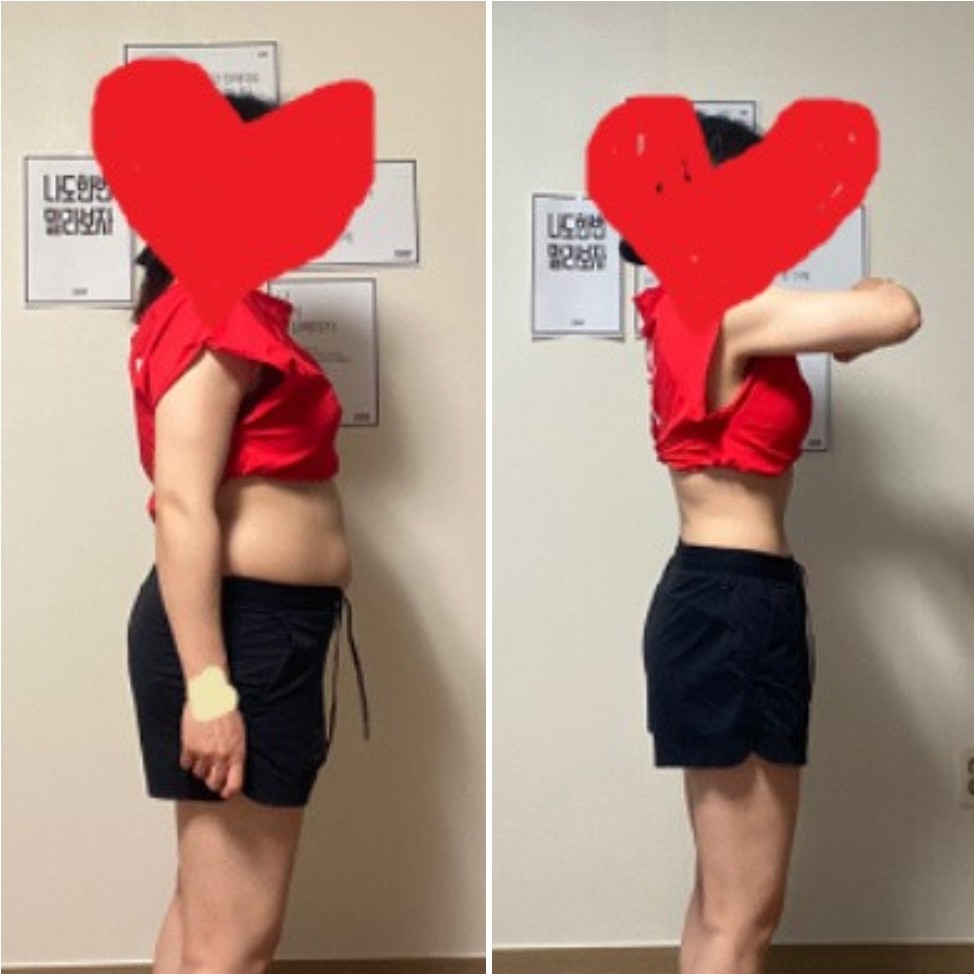 45기 / 35세 / 회사원 / 한국거주 / 폭식증 / -12kg 감량성공