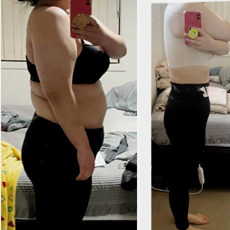  48기 / 28세 / 호주 거주 / 폭식증 / -20kg 감량성공