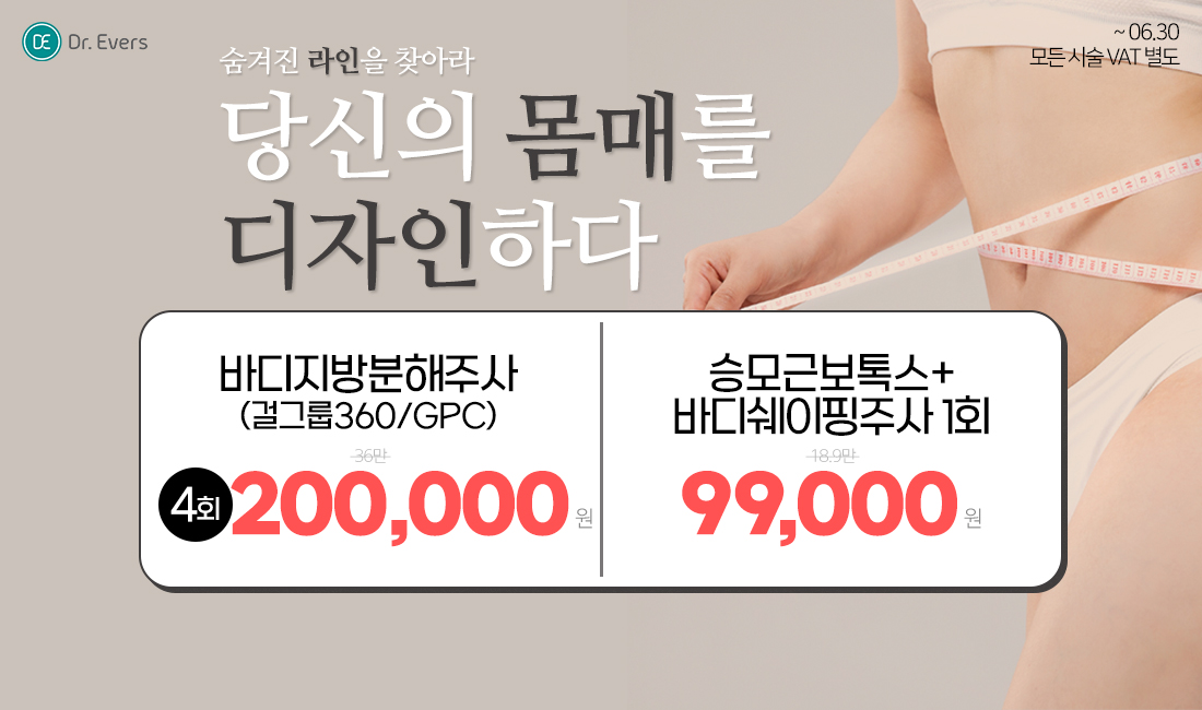 체형이벤트