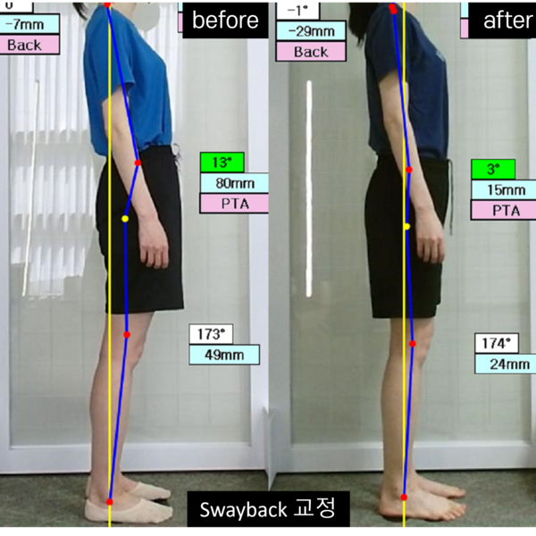 [서울 강남] 조영채 바른체형연구소