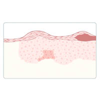 Skin immunity and inflammation : INFOGRAPHY (인포그라피)
