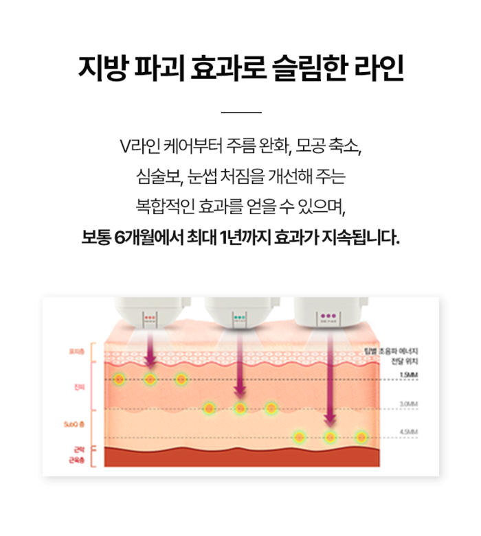 피부 다이어그램 문신의 레이어