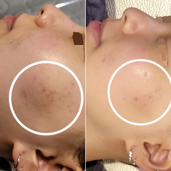 [강원 원주] 더 맑은스킨 원주혁신점