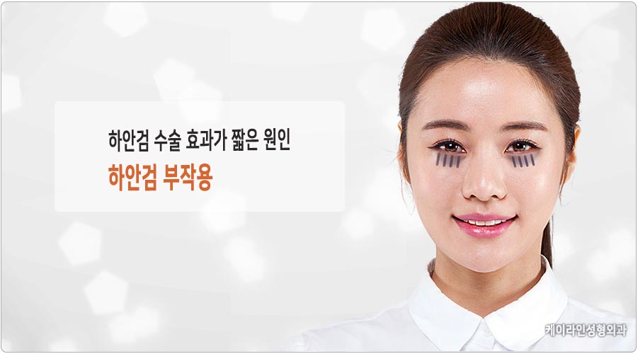 하안검 수술 효과가 짧은 원인이 뭘까요~ 하안검 부작용 : 케이라인 자주묻는질문