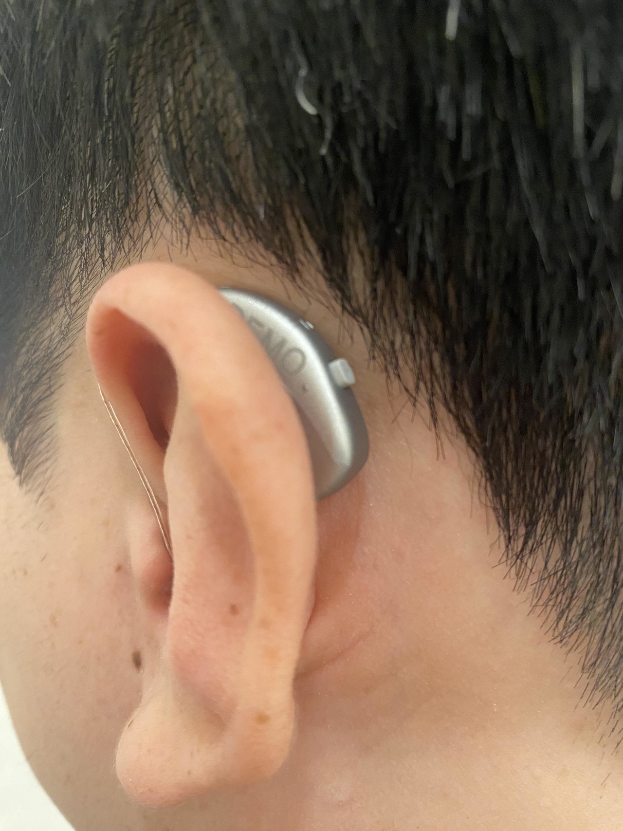 <br><p style ="font-size : 18px; font-weight : bold;">RIC (오픈형 경중고도)</p>