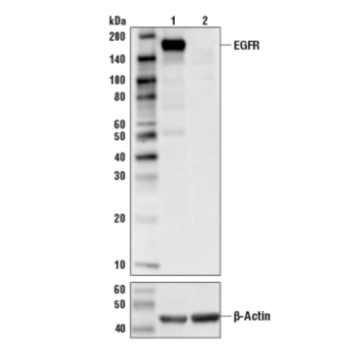 EGF Receptor (D38B1) XP® Rabbit mAb : HLB바이오스텝 B2B MALL