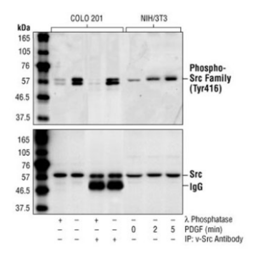 phospho Src antibody : Saintone(주)