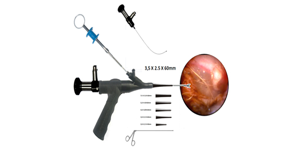 Ultra - thin Micro Otoscope