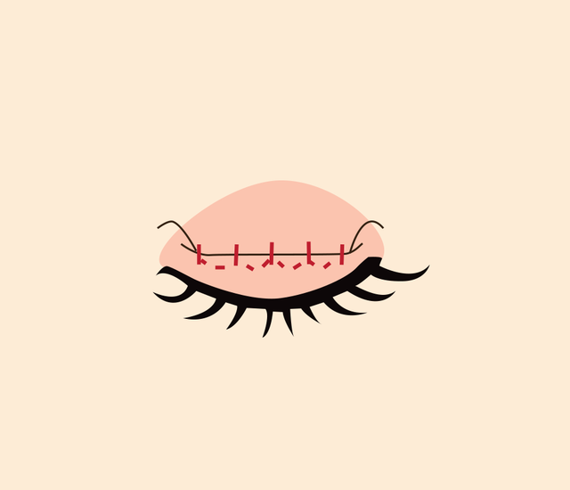 <br><p style="font-size: 20px;">쌍꺼풀 만드는 단계</p>