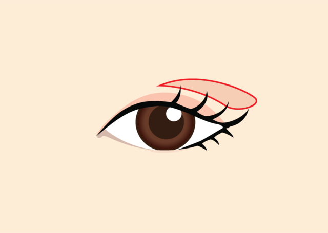 <br><p style="font-size: 20px;">처진 정도를 고려하여<br>쌍커풀 라인 디자인</p>