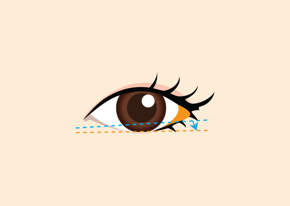 <br><p style="font-size: 20px;">눈매가 날카롭거나 눈꼬리가 올라간 경우<br>눈동자 아래라인을 이동하여 눈꼬리를 내려줌</p>