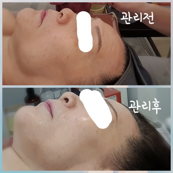 [광주 광산] 리즈