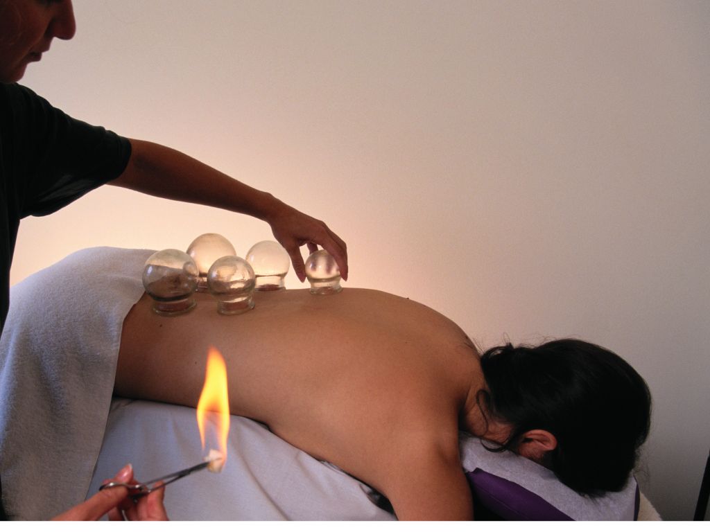 Fire Cupping image