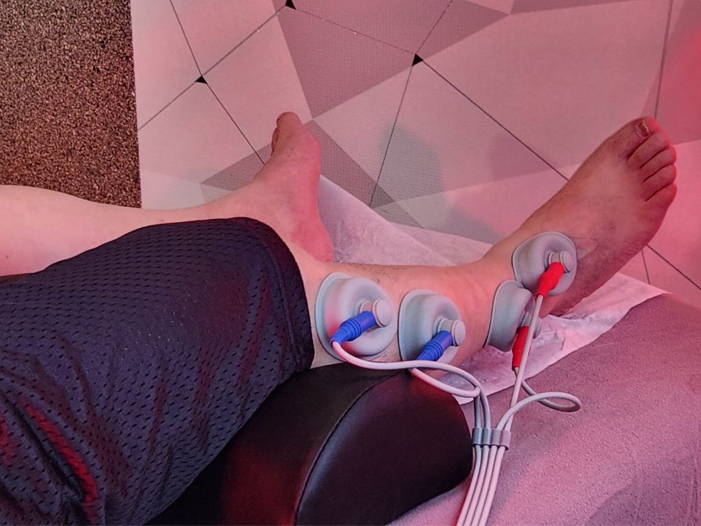 Electrical Cupping Therapy image