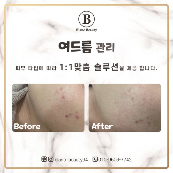 [부산 기장] 블랑뷰티