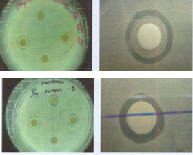“Antibacterial ability to S. aureus”
