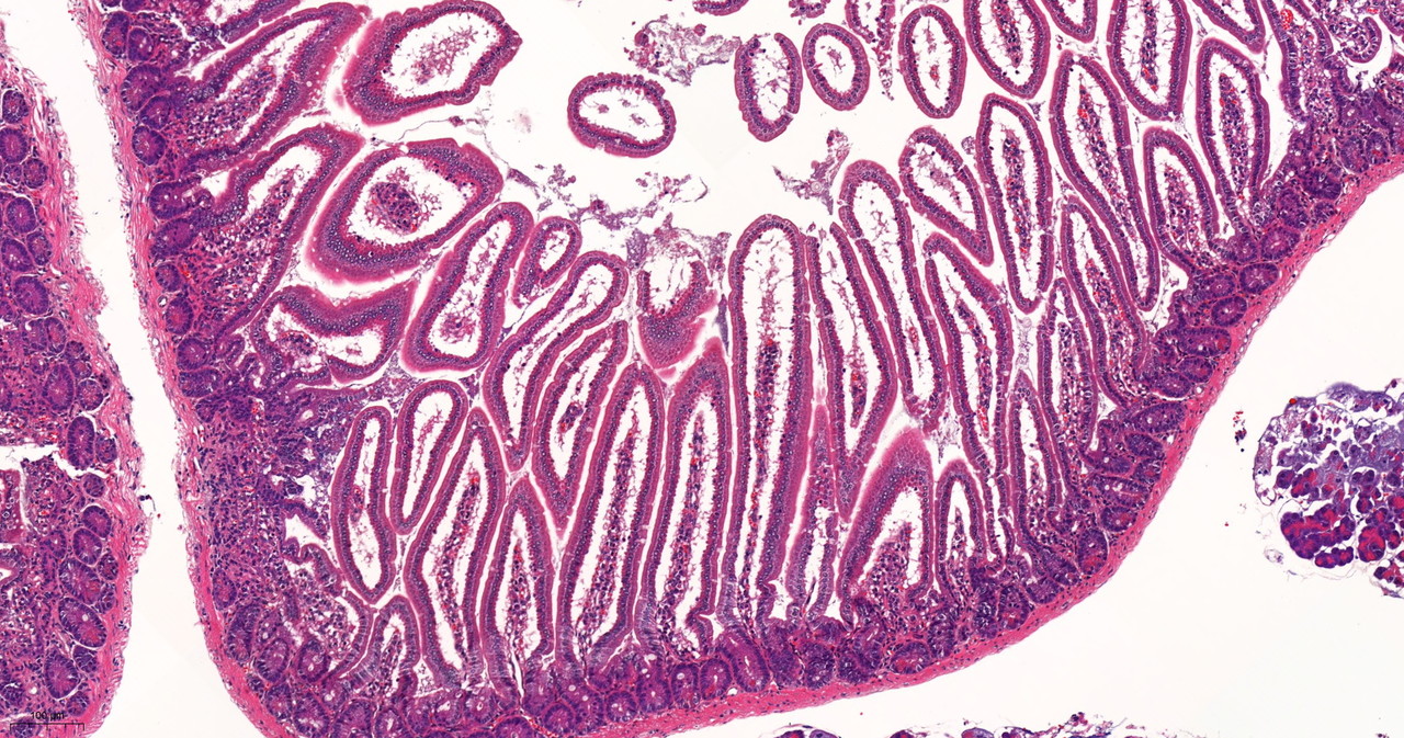 Intestine