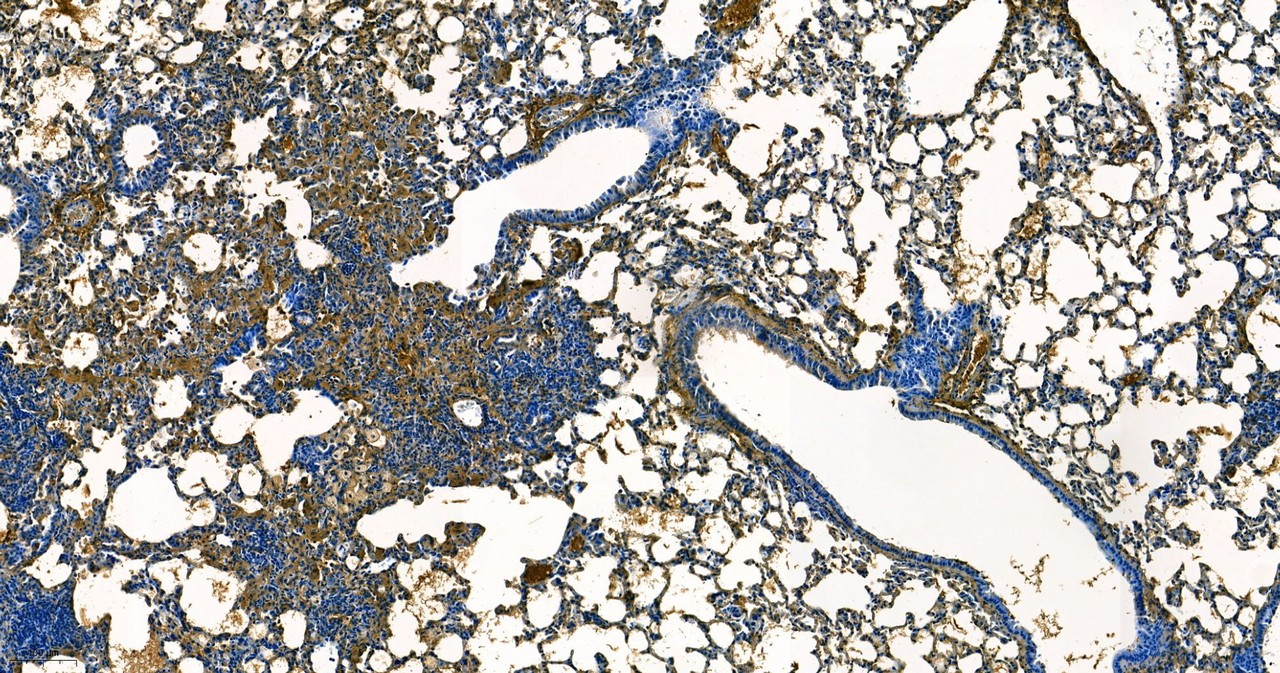 Immunohistochemistry(Idiopathic pulmonary fibrosis, Lung, Fibronectin)