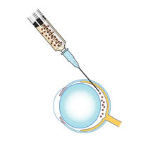 Eye injection : INFOGRAPHY (인포그라피)