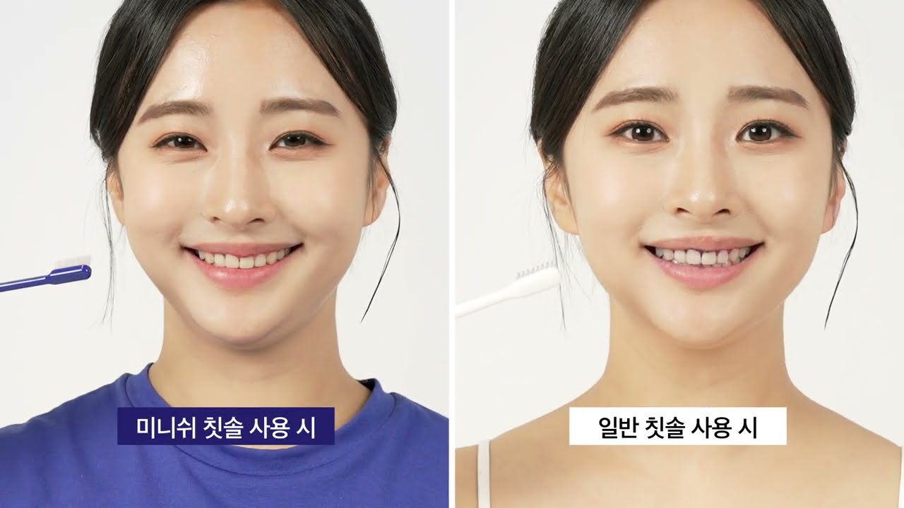 미니쉬 치석치태