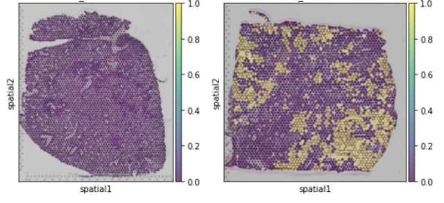특발성폐섬유화 모델동물에서 사람유래<br>줄기세포 치료제의 공간적 분포 분석<br>(왼쪽: 대조군, 오른쪽: 시험군)