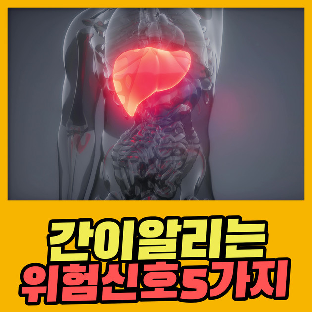 간에서 보내는 위험 신호 다섯 가지 : 건강검진정보