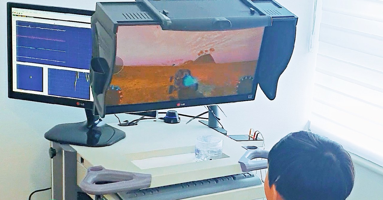 뉴로피드백