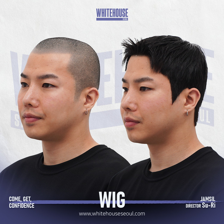 WIG : 화이트하우스서울