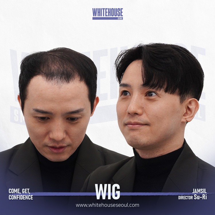 WIG : 화이트하우스서울