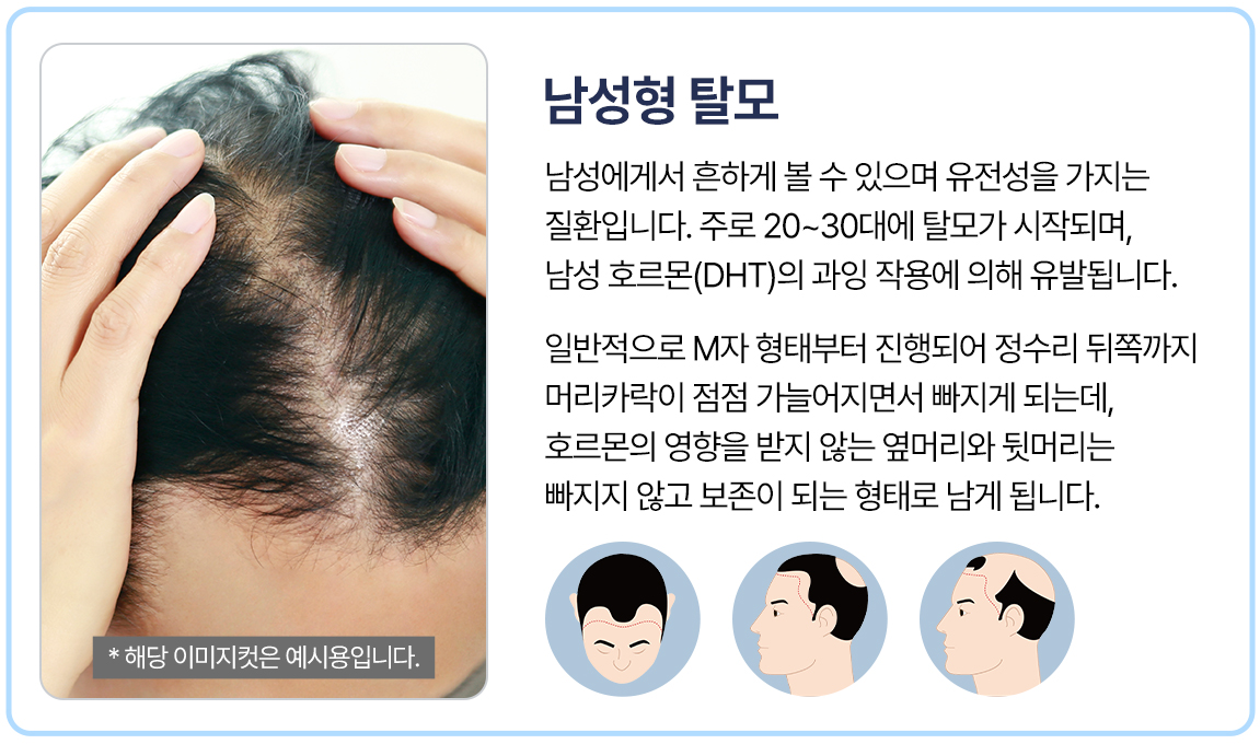 남성형
