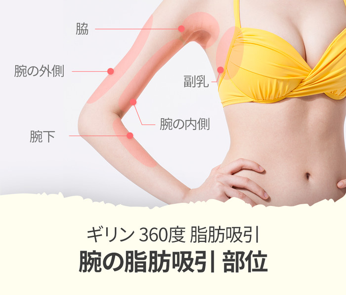 脂肪吸引