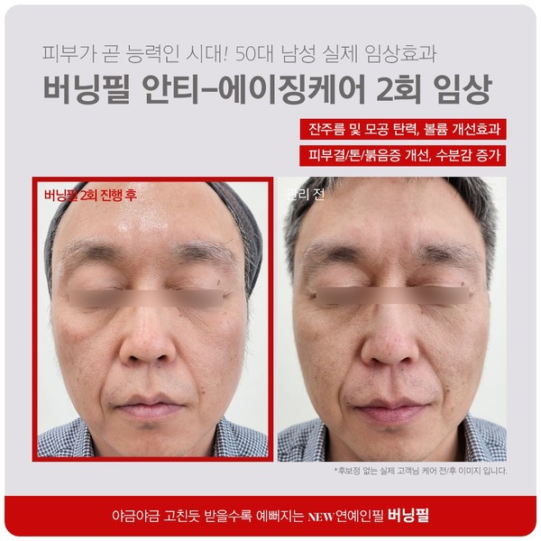 [경기 화성시] 애기스킨