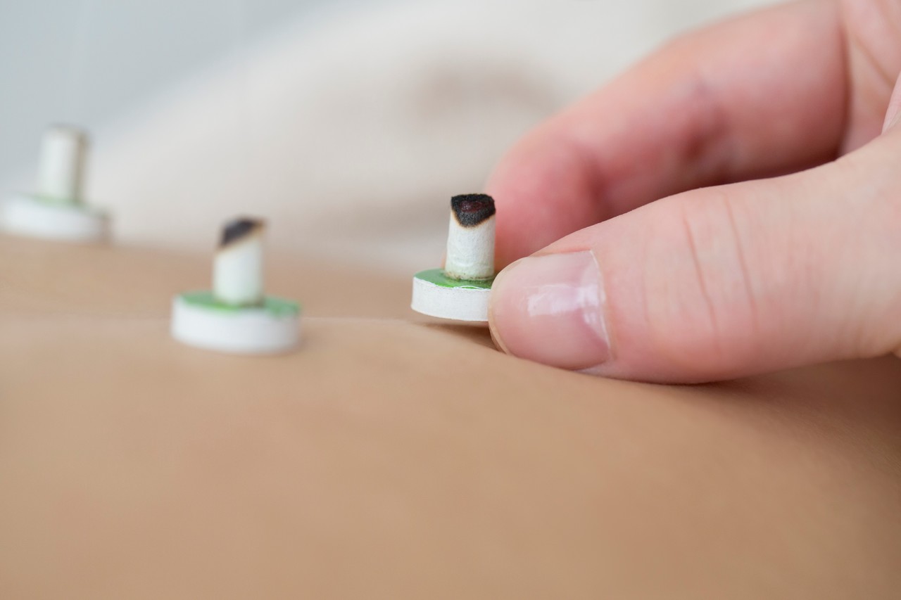 <p style="padding:20px 0px 0px 15px; text-align: left;"><span style="font-size: 26px; font-family: Pretendard, Roboto, 맑은고딕;"><span style="letter-spacing: -1px; color: rgb(43, 43, 43);"><strong>뜸치료</strong></span></span></p>    <p style="padding:0px 0px 10px 15px; text-align: left; font-size: 20px; font-family: Pretendard, Roboto, 맑은고딕;">위장,운동성 향상</p>