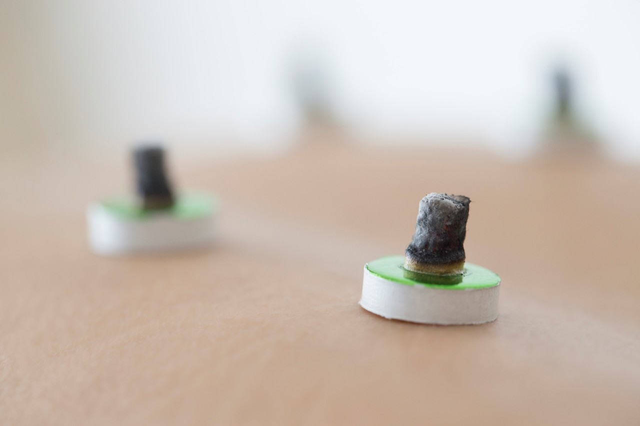 <p style="padding:20px 0px 0px 15px; text-align: left;"><span style="font-size: 26px; font-family: Pretendard, Roboto, 맑은고딕;"><span style="letter-spacing: -1px; color: rgb(43, 43, 43);"><strong>뜸 치료</strong></span></span></p>      <p style="padding:0px 0px 10px 15px; text-align: left; font-size: 20px; font-family: Pretendard, Roboto, 맑은고딕;">팔꿈치 인대 손상의 회복을 위한 뜸 치료</p>