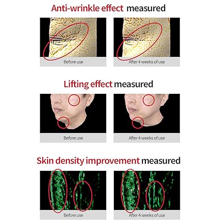  Dr.Different VITALIFT-A - Retinal Anti-Aging And Anti-Wrinkle  Night Treatment For Lifting And Firming-Face Moisturizer Cream With Vitamin  A & Hyaluronic Acid - Hydrating Cream For Men & Women 0.7oz. : Beauty