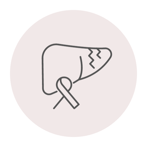 간암