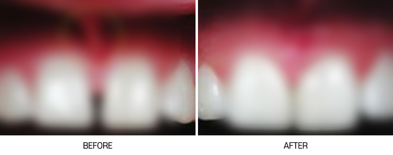 로그인 후 전후사진 게시판에서 확인가능합니다