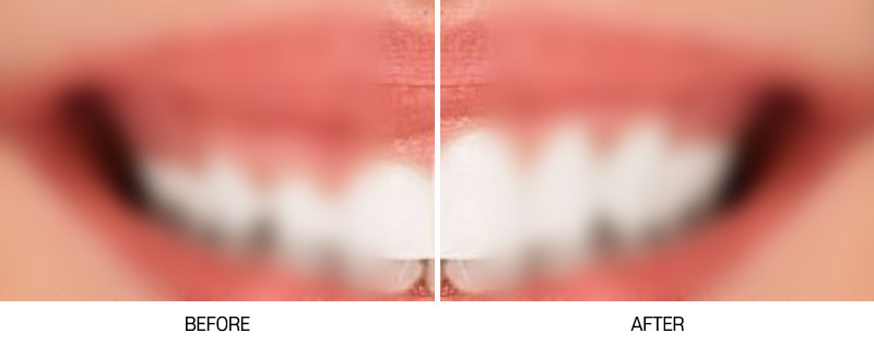 로그인 후 전후사진 게시판에서 확인가능합니다