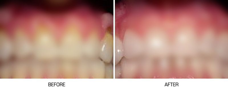 로그인 후 전후사진 게시판에서 확인가능합니다
