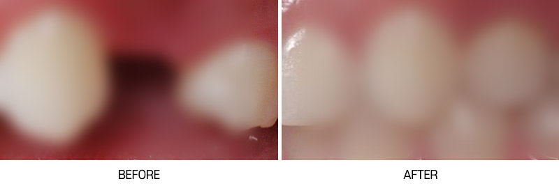 로그인 후 전후사진 게시판에서 확인가능합니다