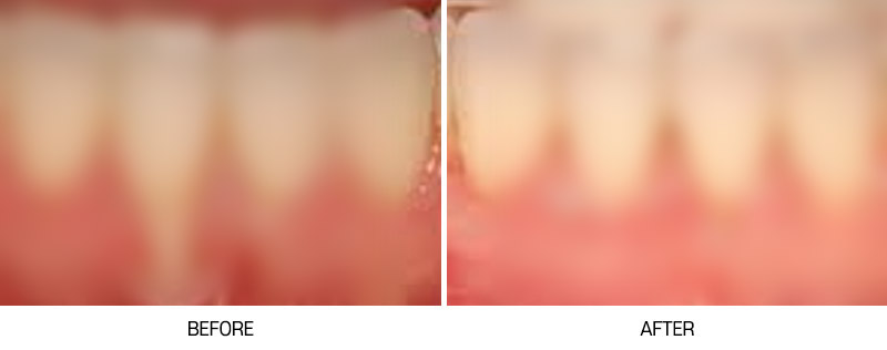 로그인 후 전후사진 게시판에서 확인가능합니다
