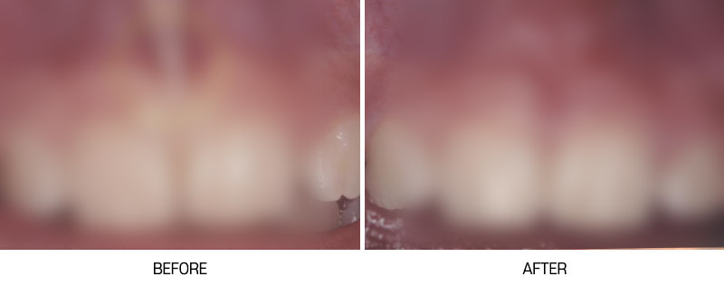 로그인 후 전후사진 게시판에서 확인가능합니다