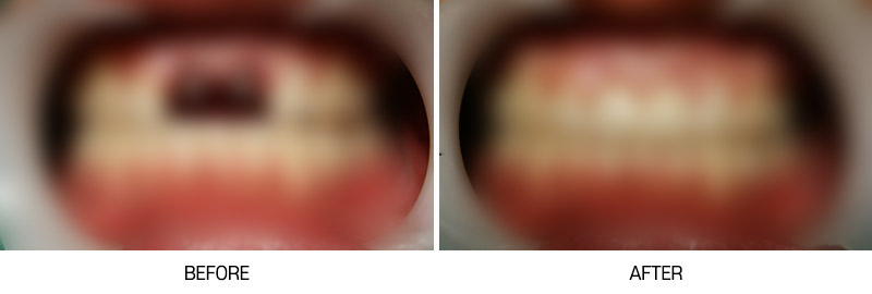 로그인 후 전후사진 게시판에서 확인가능합니다