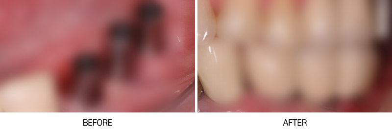 로그인 후 전후사진 게시판에서 확인가능합니다