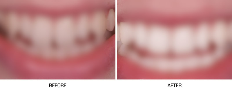 로그인 후 전후사진 게시판에서 확인가능합니다