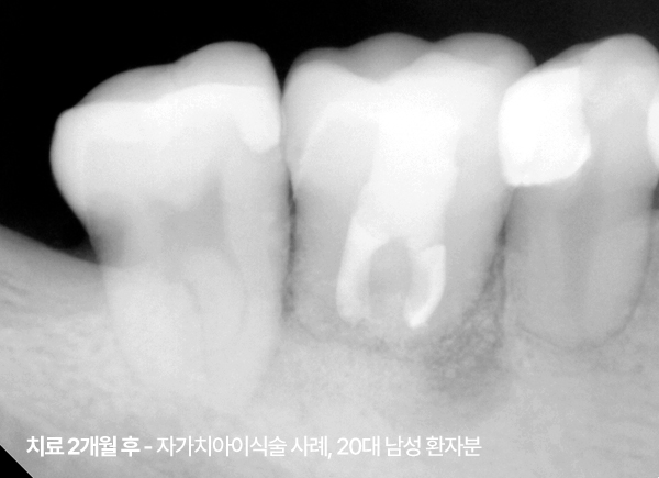 <STRONG>21. 08. 20</STRONG>